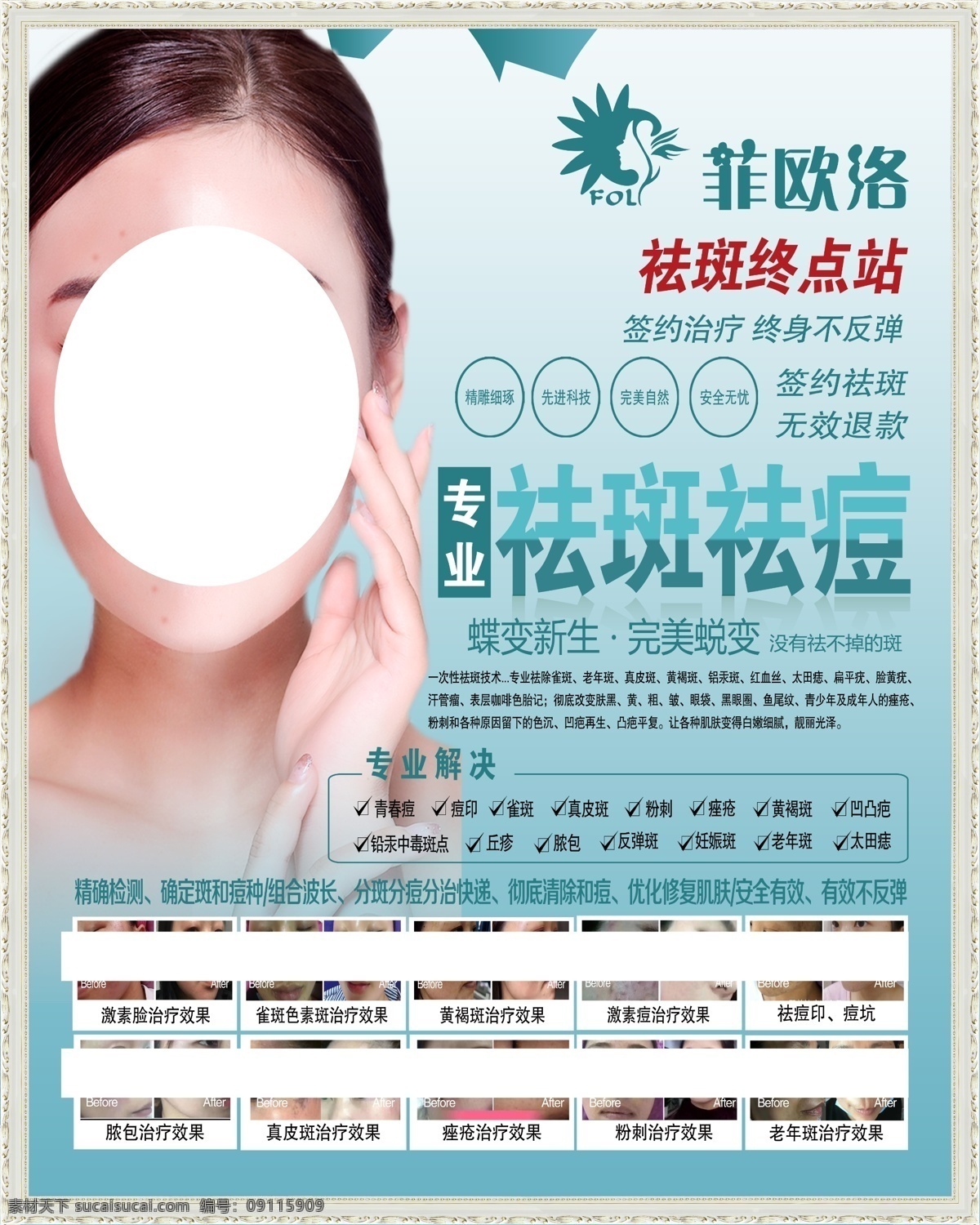 菲 歐洛 祛斑 海報 菲歐洛 祛斑海報 祛斑美女 美容美女 祛痘 祛斑祛痘 祛痘海報 祛斑展架 祛痘展架 美容祛斑 美容祛痘 祛斑效果 專業(yè)祛斑 專業(yè)祛痘 祛斑對比 簽約祛斑 美容紋繡 紋繡海報 美容海報 祛斑易拉寶 祛斑廣告 美容廣告 整形海報 醫(yī)療整形 整形減肥 整形美女