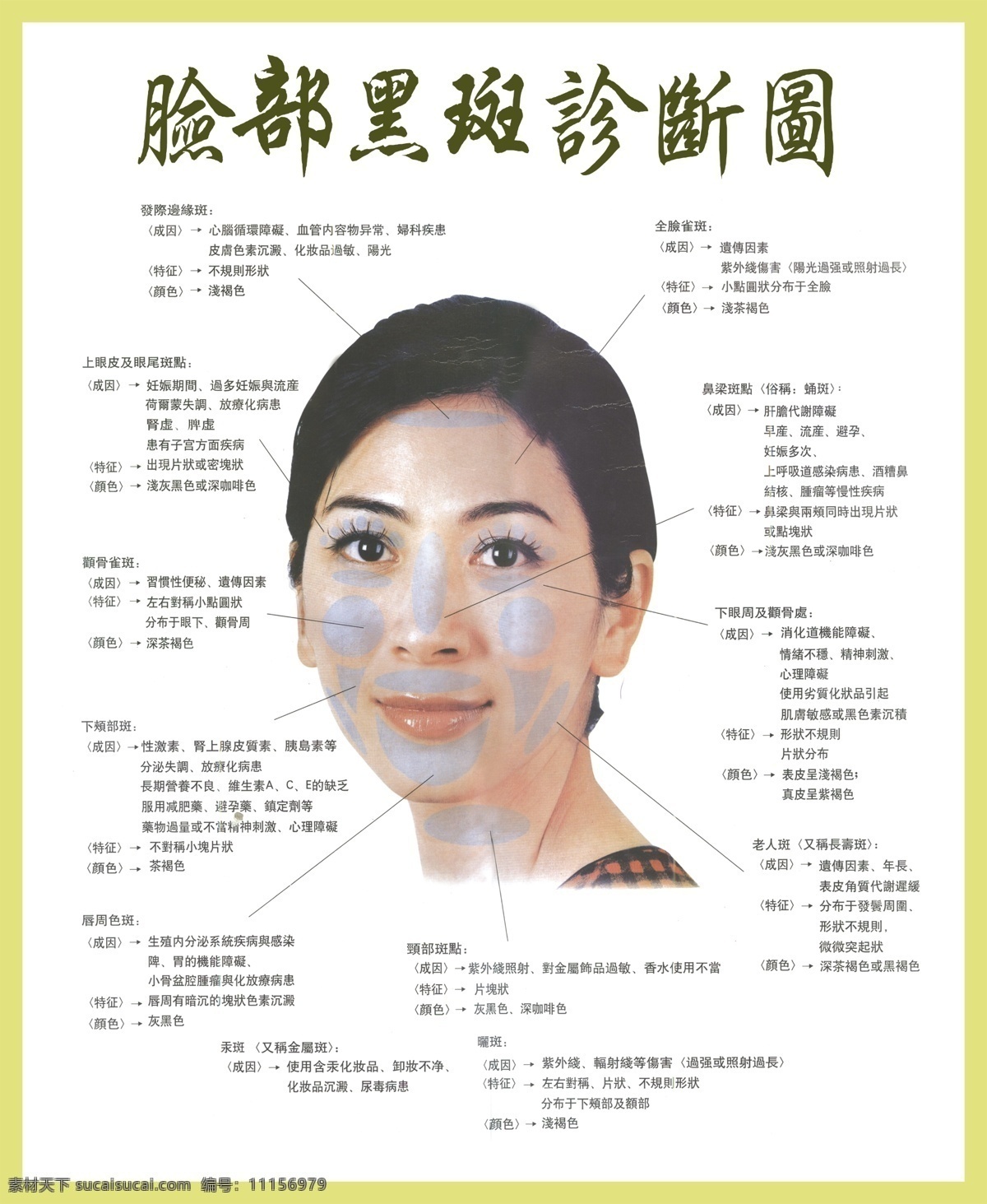 臉部 黑斑 診斷 圖 黑斑診斷 臉 女人 診斷圖 臉部穴位圖 穴位圖分布圖 穴位 分布圖 廣告設計模板 源文件