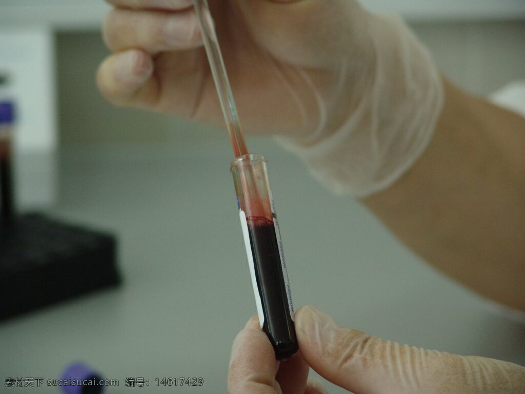 實驗室 血液檢測 醫(yī)療研究 化驗試管 醫(yī)學實驗 科學研究 實驗室設(shè)備 醫(yī)護人員 血液分析 醫(yī)療科技 實驗室環(huán)境 醫(yī)學檢驗