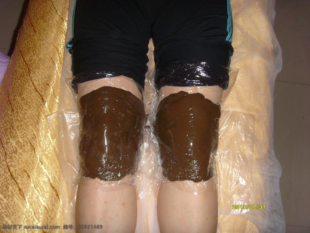 泥灸图片 泥灸 药灸 膝盖泥灸 膝盖护理 泥灸效果 医疗护理 现代科技