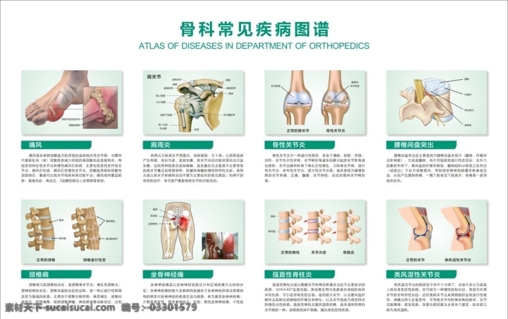 医院 骨科 常见疾病 图谱 解剖图 颈椎病 肩周炎 腰椎间盘突出 坐骨神经痛 痛风 风湿 关节炎