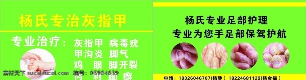 灰指甲名片 灰指甲简介 灰指甲修脚 灰指甲宣传单 灰指甲广告 名片卡片