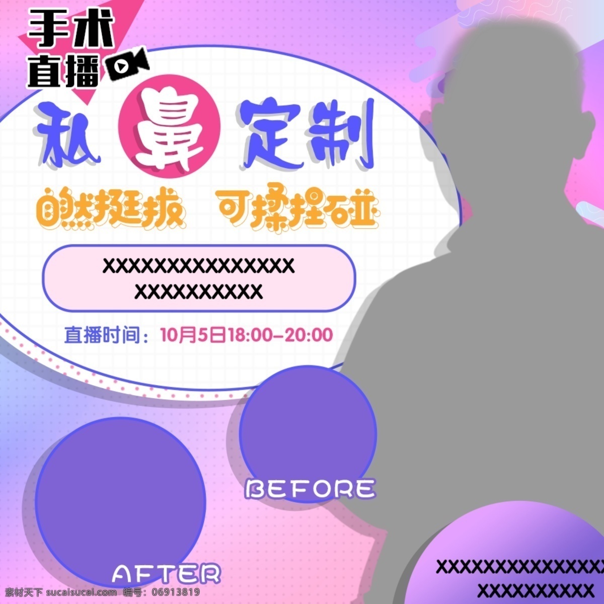 美鼻 定制 手术直播 头 图 整形 网页 直通车 模板 手术 直播