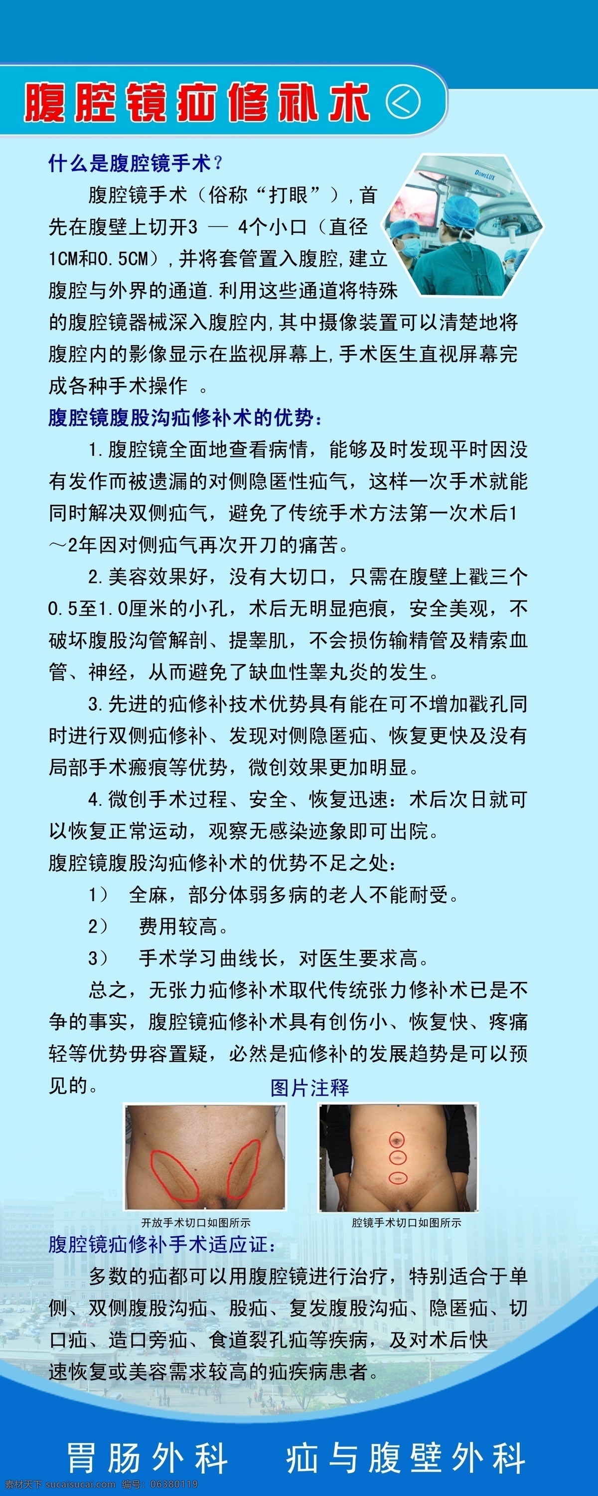 医院易拉宝 医院 易拉宝 疾病 介绍 治疗 展板模板 广告设计模板 源文件