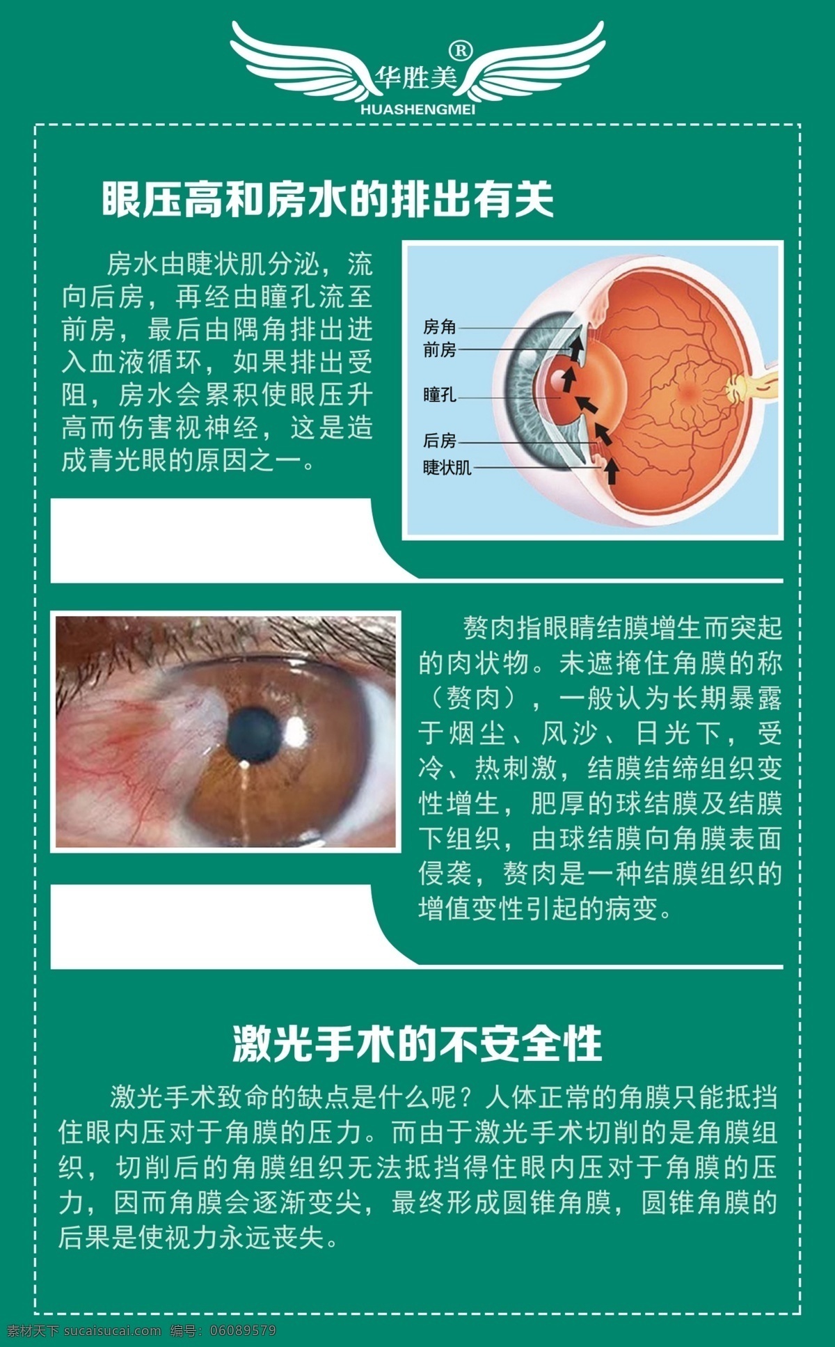 眼球结构图 好视力眼贴 好视力 眼贴 眼睛 眼科 眼镜 亨柏眼镜 眼球 结构图 眼睛制度 护眼 视力保护 雾美优视 视力知识 保护眼睛知识