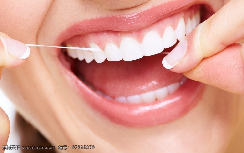 牙箍 牙套 牙线 洁白牙齿 牙齿矫正 口腔护理 牙科 牙模型 生活百科
