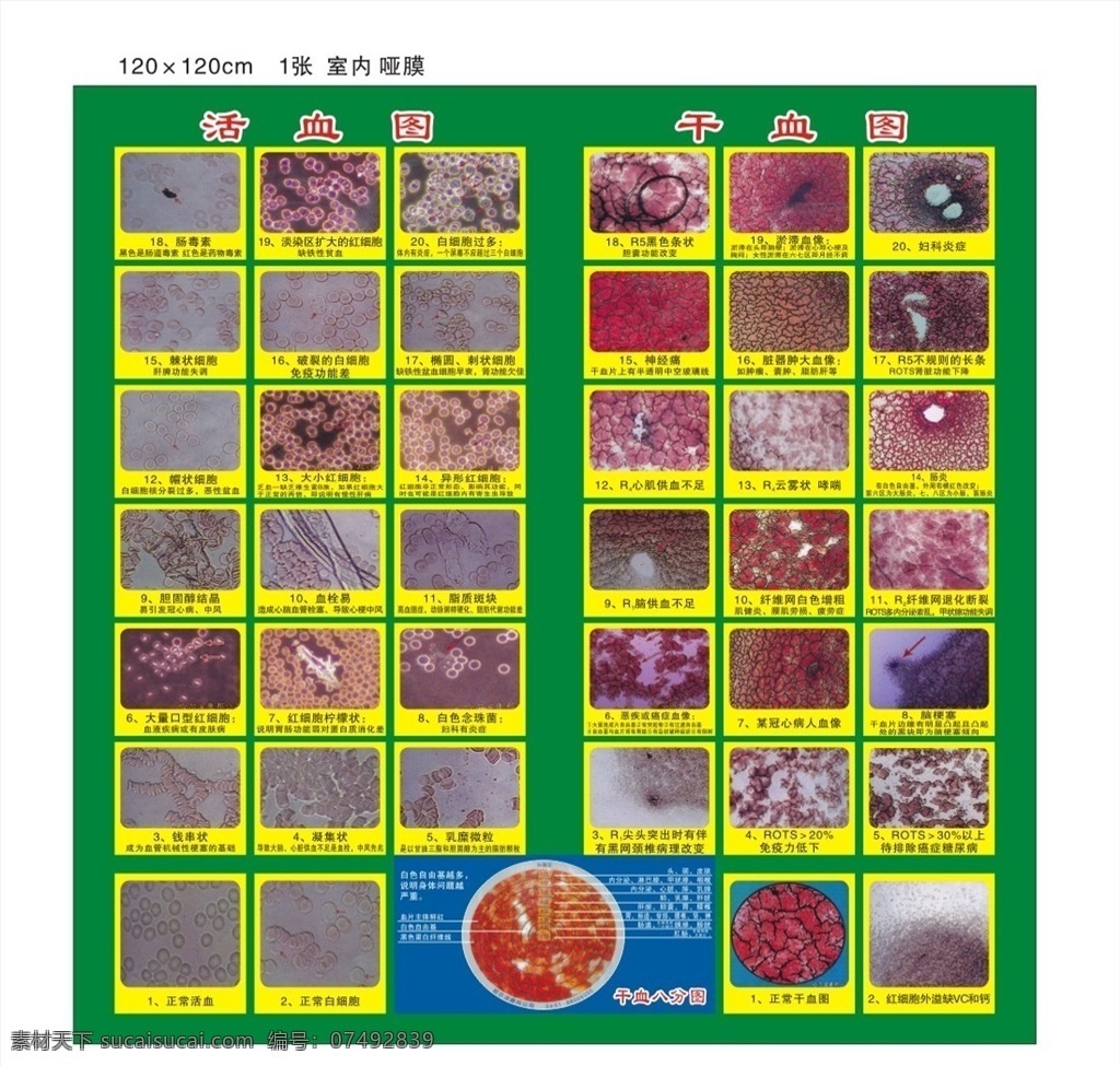 活血 干血八分图 活血图 干血图 细胞图 模板