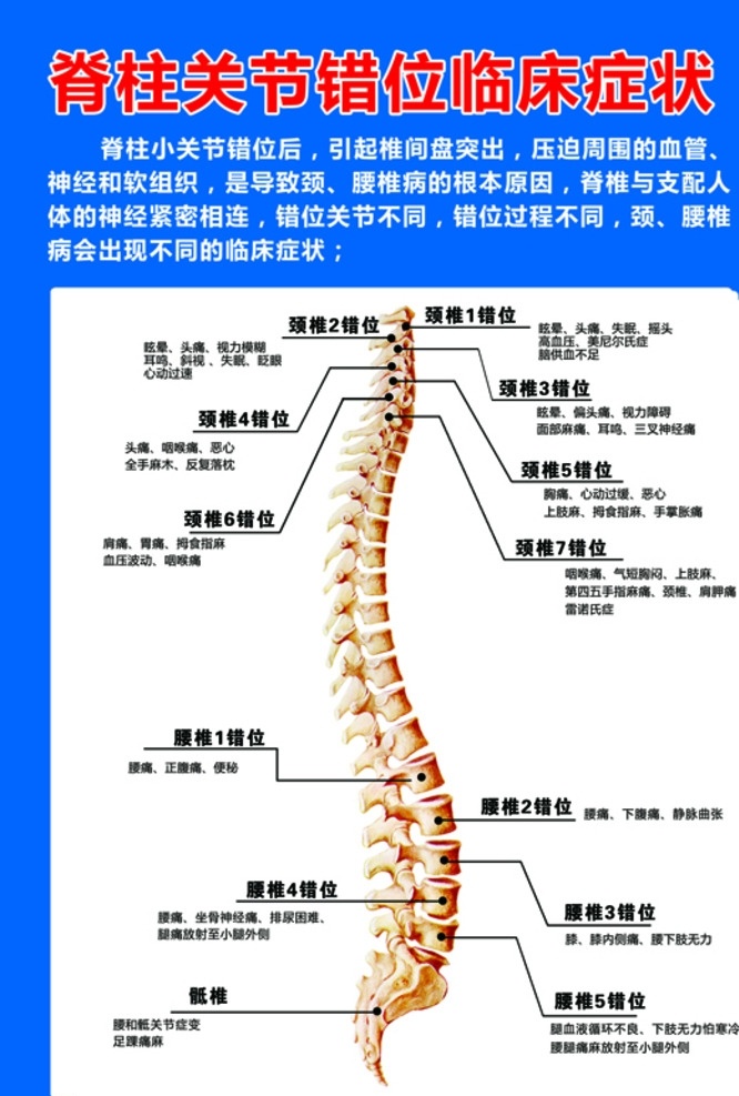 脊柱展板 脊柱 关节 错位 病变 症状
