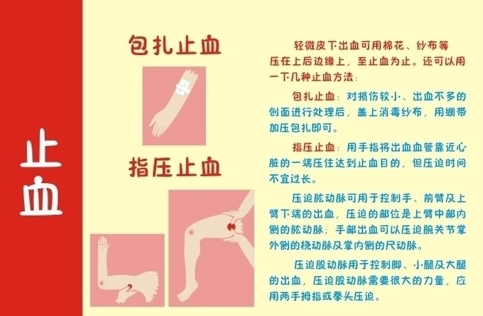 止血方法 包扎止血 指压止血 手 膝盖 手臂 手关节 止血矢量 健康类素材 矢量素材 其他矢量 矢量