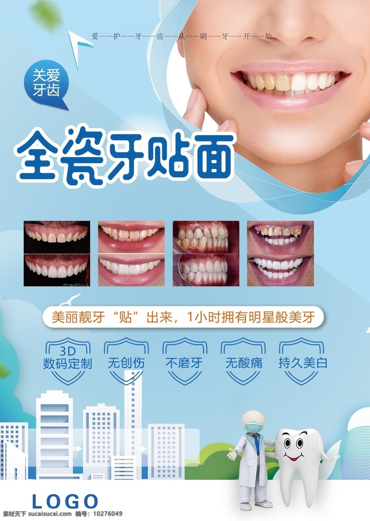 牙科展板 口腔科展板 全瓷牙贴面 蓝色背景 关爱牙齿 正畸适应症 全瓷牙贴面图
