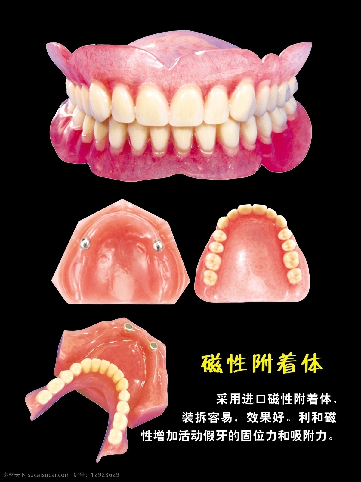 磁性 附着 体 牙科 牙套 牙齿 假牙 其他模版 广告设计模板 源文件