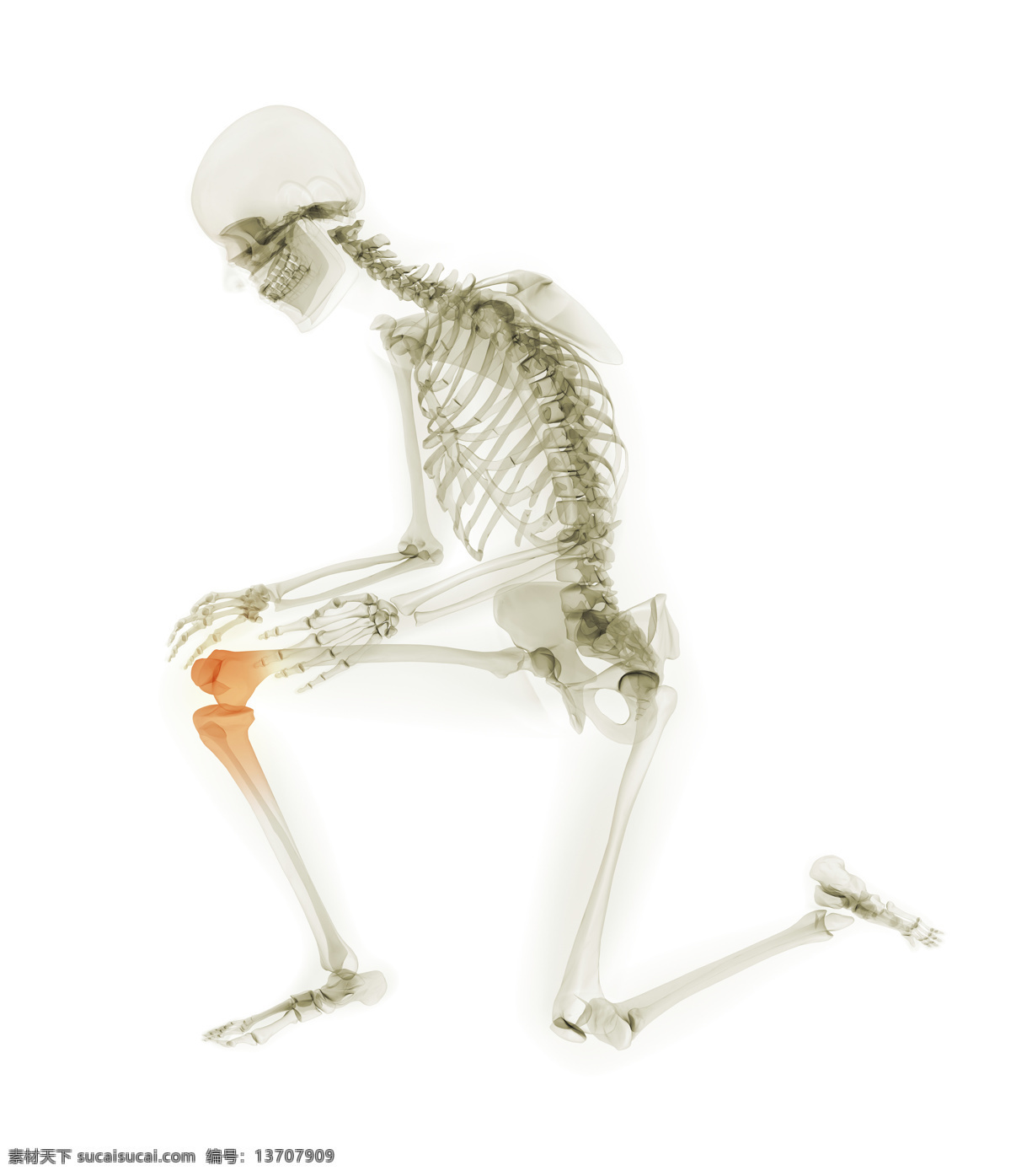 人体 膝关节 x 光 透视图 x光 图像 医疗主题 医疗护理 现代科技