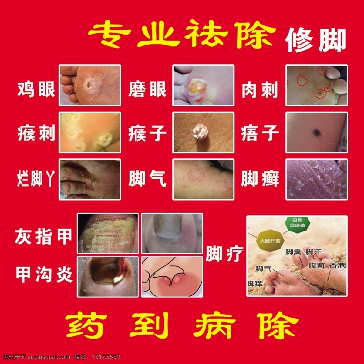 专业修脚 修脚广告 修脚海报 分层素材 分层