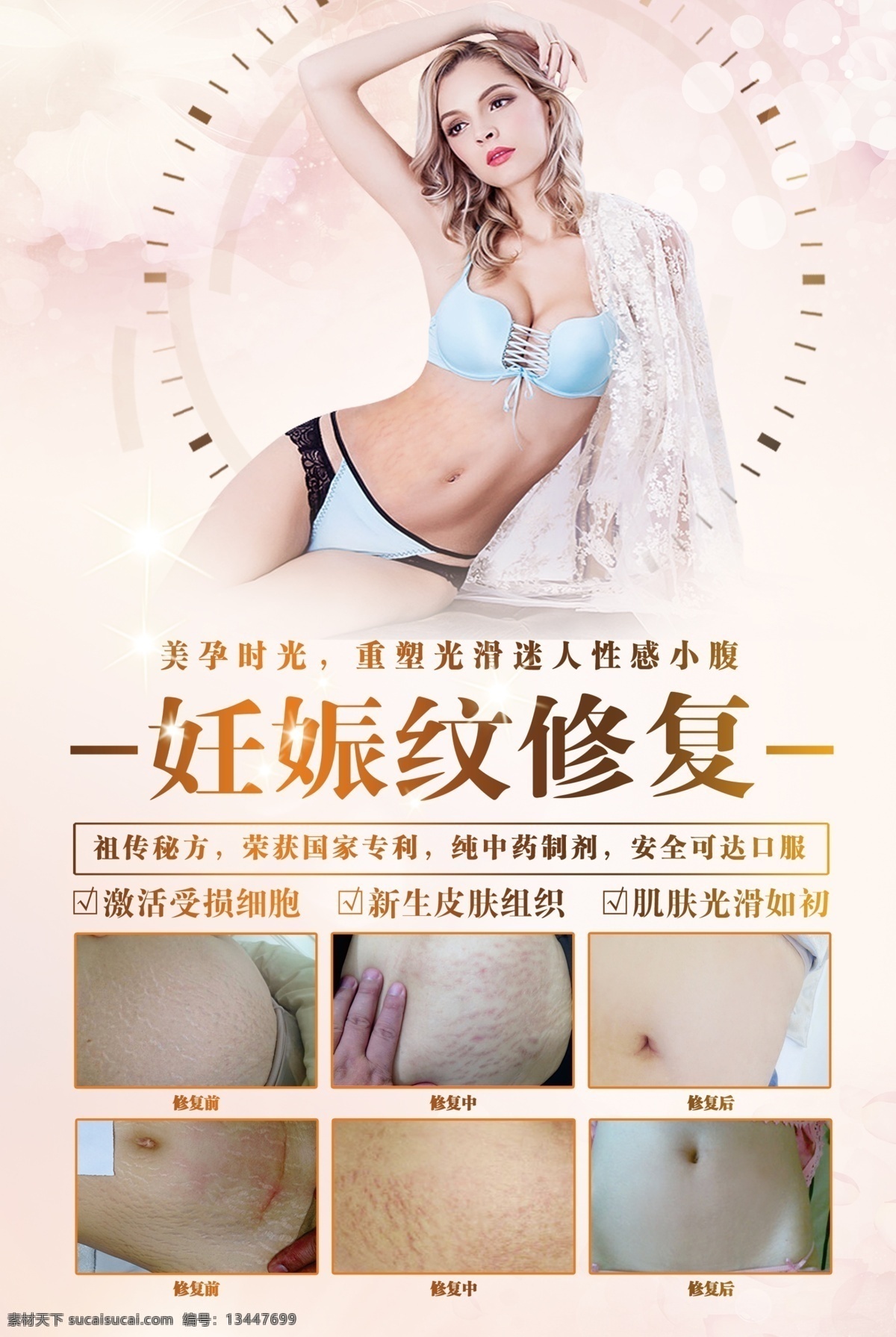 妊娠纹修复 妊娠纹 海报 修复 专家 产后 展架 腹部